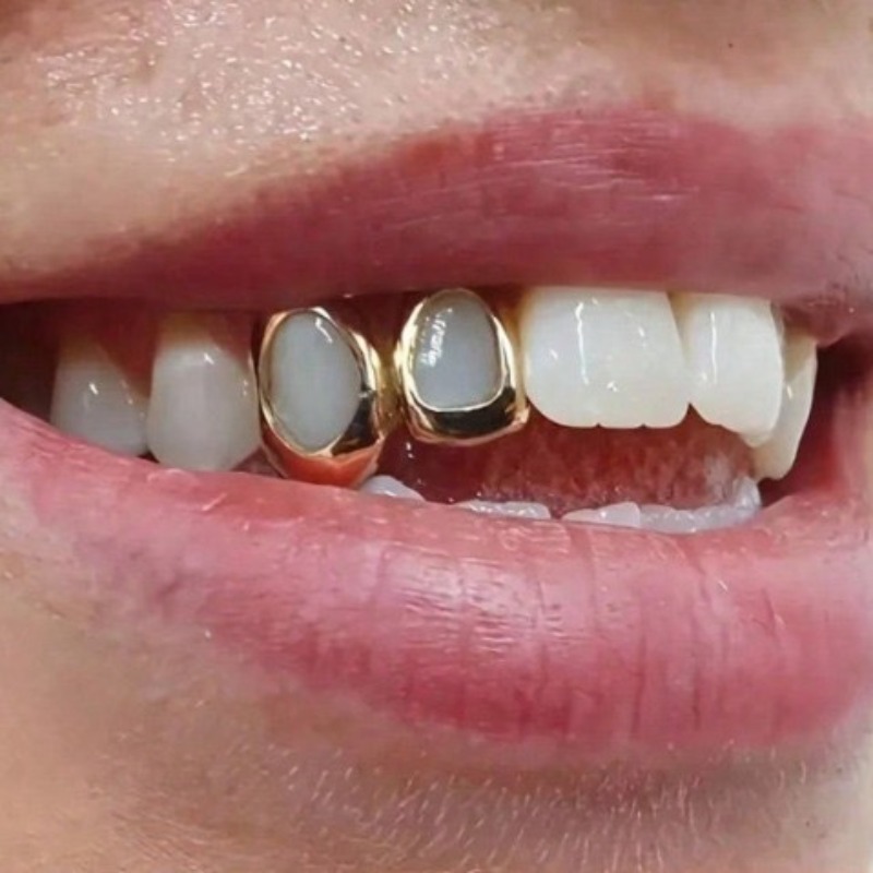 Набор золотых зубных украшений – обзор и цена Body Jewelry Lot